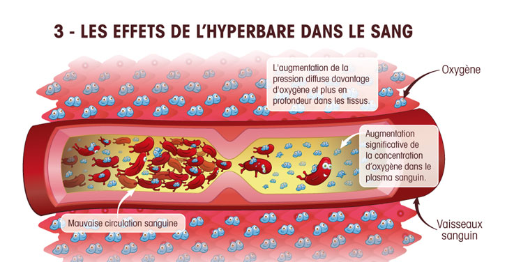 Oxygenhyperbarre3dans-systeme-sanguin